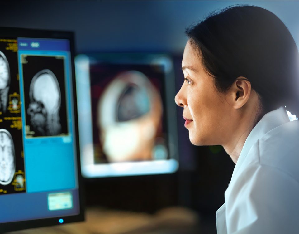 asian woman looking at brainscans on computer