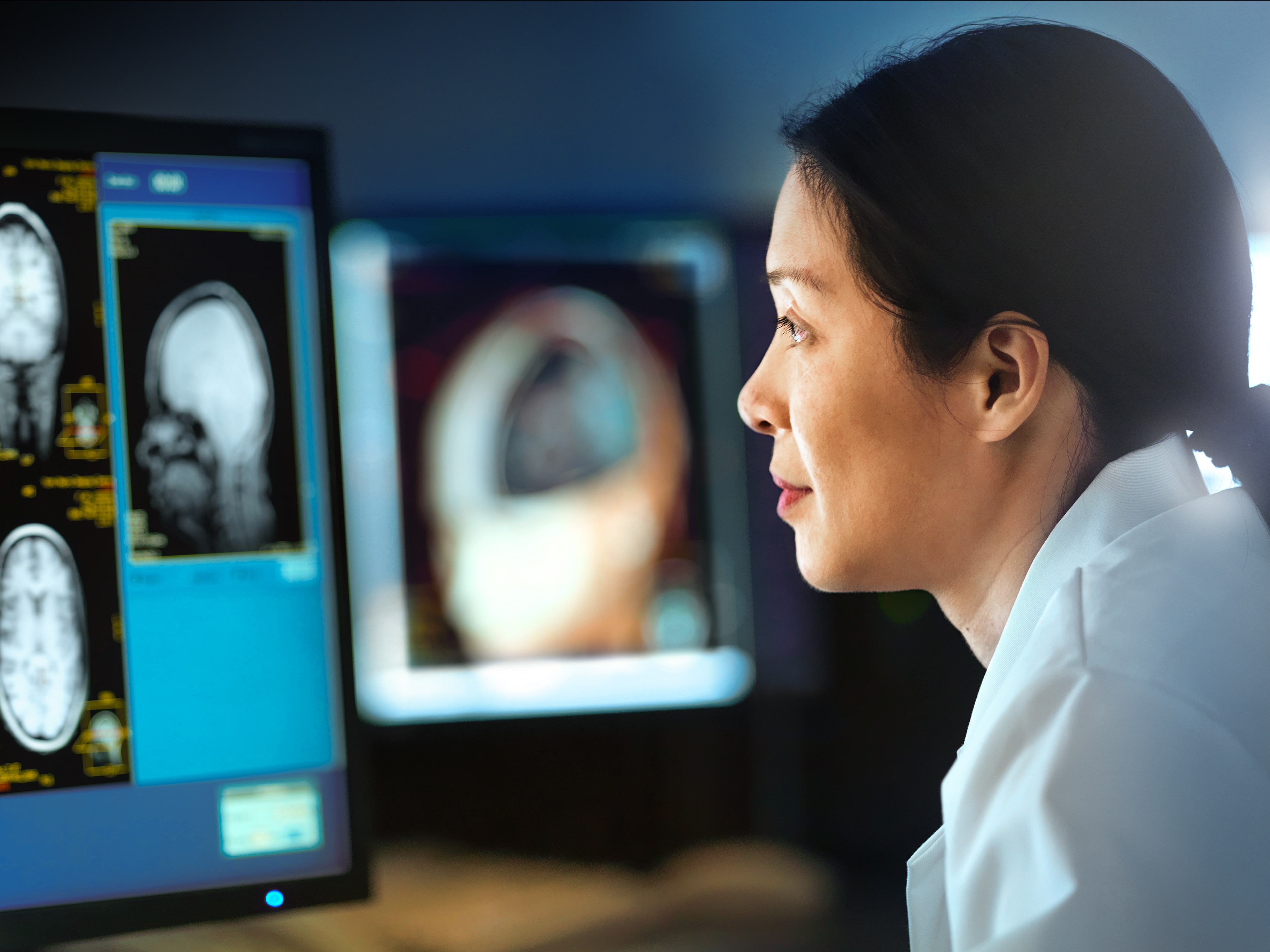 asian woman looking at brainscans on computer